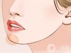 下颌角手术有风险吗？下颌角手术多少钱？再看医院介绍