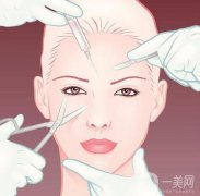 超肋隆鼻手术过程以及多久恢复自然有答案啦！