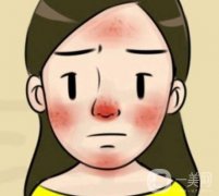 酒渣鼻可以自愈吗，调节方法有哪些