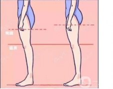 抽脂多少钱一次？抽脂有什么风险和后遗症？