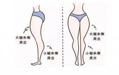抽脂减肥价格一览表2024，抽脂减肥安全性一次了解