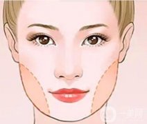 面部适合水动力吸脂吗？安全吗