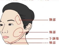 颧骨提升术有风险吗？有哪些后遗症