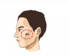 颧骨缩小术有危险吗？哪些人适合