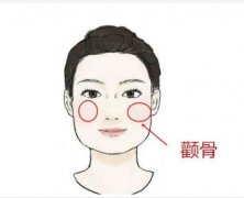 颧骨切开术原理是什么，有什么副作用