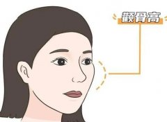 颧骨前突怎么改良？教你六招，全方位改良指南！