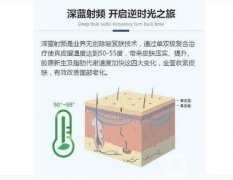 深蓝射频有什么作用？多久做一次比较好