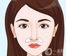 填充鼻基底的材料有哪些，一般需要多少钱