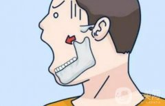 如何改良大颧骨？磨骨手术注意事项盘点