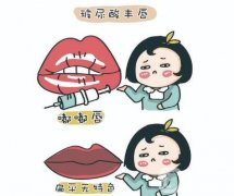 丰唇后多久可以消肿？有哪些副作用