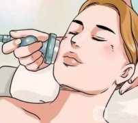 激光点阵有哪些优点？如何护理