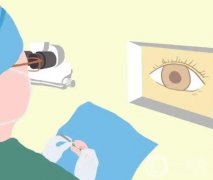 近视手术的缺点有哪些