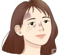 激光调节黄褐斑手术后常见问题有哪些？