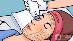 小热玛吉是什么？超声炮好还是热玛吉好？一文讲清