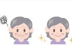 完成光子嫩肤后要注意什么？