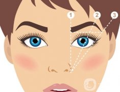 填充眉弓有哪些方法？用什么材料填充眉弓比较好