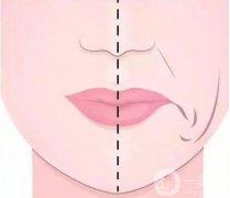 填充鼻基底的方法有几种？
