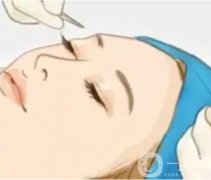 影响开眼角手术价格的因素有哪些？