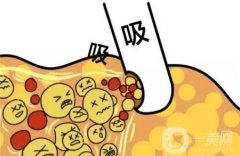 背部吸脂的并发症有哪些？