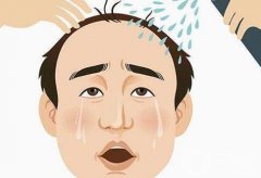 植发1000单位有多大面积？费用大揭秘！