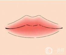 玻尿酸丰唇后如何快速消肿