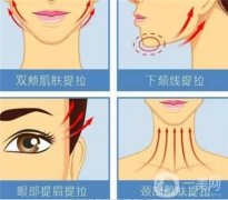 超声刀除皱有什么优点和缺点