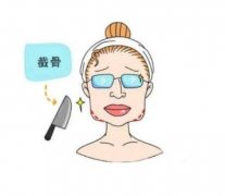 截骨术有哪些副作用，费用是多少