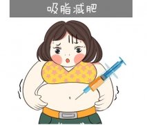 哪里可以做吸脂减肥？