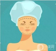 面中部除皱术的适应症有哪些