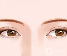 切眉术不适合哪些人，手术前后应注意哪些事项