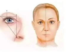 切眉的效果能维持多久？术前要做哪些准备