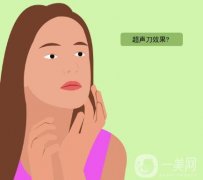 超声刀有哪些优点？哪些人群适合适合做