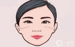 颧骨颧弓修复手术怎么做？多少钱？专业靠谱医院推荐