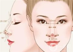 大蒜鼻整形术有风险吗？有哪些风险？