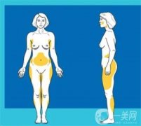 小腿吸脂有效吗？吸脂术前术后要注意什么