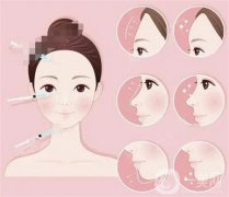 自体脂肪填充泪沟后要注意什么