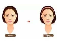 影响面部光纤溶脂价格的因素有哪些