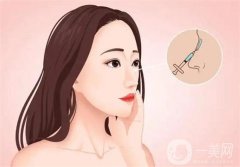 北大深圳医院隆鼻案例分享！附崔永言、李天石医生专业擅长一览