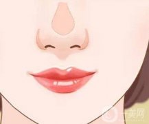 什么是鼻翼缩小缩小手术，费用是多少