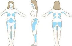 抽脂减肥的疼痛如何缓解