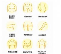 腹部吸脂手术效果如何？