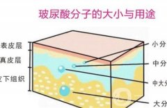 玻尿酸和线雕有什么区别？