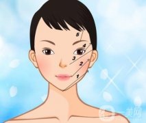 青春肽支架面部提升的优势有哪些