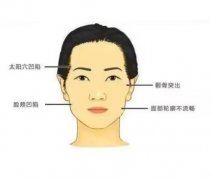 颧骨缩小术的效果能维持多久？