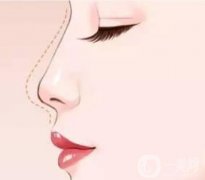 鼻综合感染的常见症状有哪些？