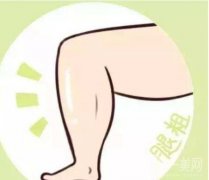 大腿环吸的特点有哪些