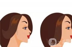 截骨手术可能引起哪些并发症