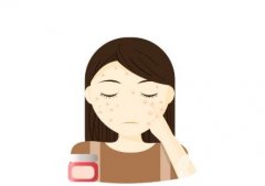 激光祛痘印的原理是什么，有什么注意事项？