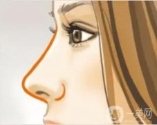 什么是线雕隆鼻，有哪些危害