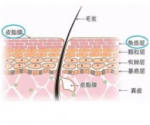 果酸换肤多久做一次比较好？
